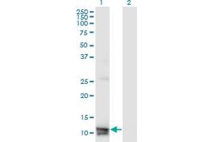 Western Blot analysis of MLN expression in transfected 293T cell line by MLN monoclonal antibody (M07), clone 4E12. (Motilin Antikörper  (AA 1-115))