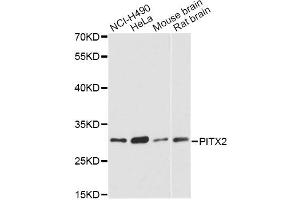 Western blot analysis of extracts of various cell lines, using PITX2 antibody. (PITX2 Antikörper)