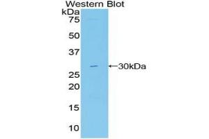 Western blot analysis of the recombinant protein. (MIB2 Antikörper  (AA 687-930))