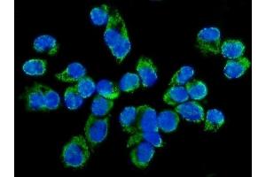 IF analysis of TARS2 using anti-TARS2 antibody (ABIN7602308).
