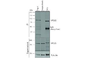 Immunoprecipitation analysis using Mouse Anti-VPS35 Monoclonal Antibody, Clone 8A3 (ABIN6932977). (VPS35 Antikörper  (PerCP))
