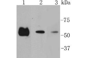Lane 1: Hela lysates, Lane 2:A431 lysates, Lane 3: PC12 lysates probed with Smad2 (9A3) Monoclonal Antibody  at 1:1000 overnight at 4˚C. (SMAD2 Antikörper)