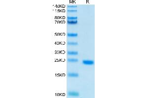 Human IL-6 on Tris-Bis PAGE under reduced condition. (IL-6 Protein (AA 30-212))