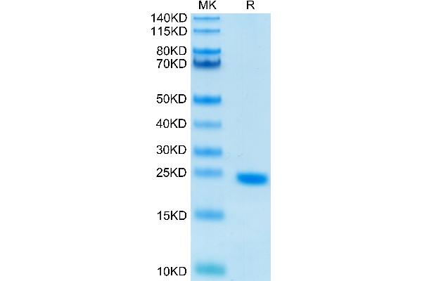 IL-6 Protein (AA 30-212)