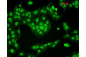 Immunocytochemistry/Immunofluorescence analysis using Mouse Anti-CaMKII Monoclonal Antibody, Clone 6G9 . (CAMKII gamma Antikörper  (FITC))