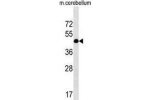 Western Blotting (WB) image for anti-RCD1 Required For Cell Differentiation1 Homolog (RQCD1) antibody (ABIN2999751) (RQCD1 Antikörper)