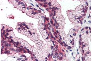 Anti-SLC39A14 antibody  ABIN960809 IHC staining of human prostate. (SLC39A14 Antikörper  (Cytoplasmic Domain))