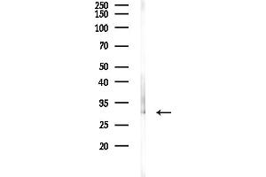 anti-phosphoglycerate Mutase 2 (Muscle) (PGAM2) (Internal Region) antibody