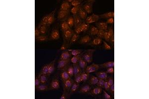 Immunofluorescence analysis of C6 cells using  antibody (ABIN7265416) at dilution of 1:100. (ACBD3 Antikörper  (AA 1-160))
