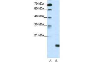 Western Blotting (WB) image for anti-TGFB-Induced Factor Homeobox 2-Like, Y-Linked (TGIF2LY) antibody (ABIN2461298) (TGIF2LY Antikörper)