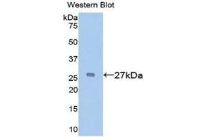 Detection of Recombinant a1BG, Mouse using Polyclonal Antibody to Alpha-1-B-Glycoprotein (a1BG) (A1BG Antikörper  (AA 313-512))