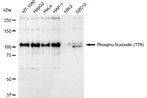 Western blotting analysis using Phospho-Nucleolin (T76) antibody (ABIN7799669).