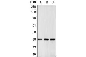Western blot analysis of BCL2 expression in MCF7 (A), mouse brain (B), rat kidney (C) whole cell lysates. (Bcl-2 Antikörper  (Center))