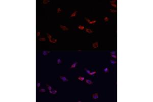 Immunofluorescence (IF) image for anti-Bone Morphogenetic Protein Receptor, Type II (serine/threonine Kinase) (BMPR2) (AA 27-150) antibody (ABIN6137608)