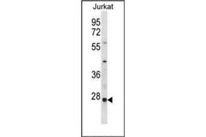 Western blot analysis of HTATIP2 Antibody (N-term) in Jurkat cell line lysates (35ug/lane). (HIV-1 Tat Interactive Protein 2, 30kDa (HTATIP2) (AA 44-74), (N-Term) Antikörper)