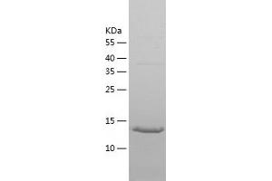 Western Blotting (WB) image for Regulator of G-Protein Signaling 21 (RGS21) (AA 1-152) protein (His tag) (ABIN7124817)