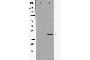 Western blot analysis of Hela cell lysate, using SULT2A1 Antibody. (SULT2A1 Antikörper  (C-Term))