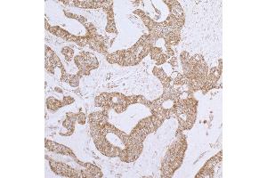 Immunohistochemistry (IHC) image for anti-Dihydrolipoamide Dehydrogenase (DLD) (AA 459-509) antibody (ABIN7453411) (DLD Antikörper  (AA 459-509))