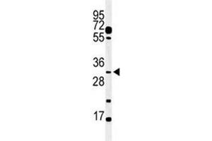 Western Blotting (WB) image for anti-Apolipoprotein B mRNA Editing Enzyme, Catalytic Polypeptide-Like 3B (APOBEC3B) (AA 299-330) antibody (ABIN3029993)
