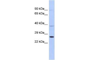 WB Suggested Anti-SAR1B Antibody Titration: 0. (SAR1B Antikörper  (Middle Region))