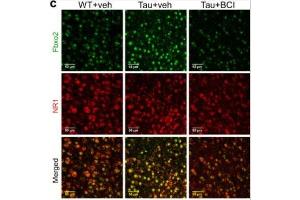 Representative fluorescence images of Fbxo2 (green) and NR1 (red, cat.