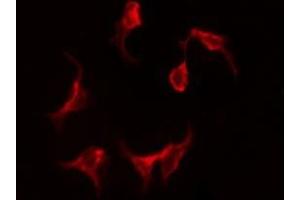 ABIN6275229 staining HeLa by IF/ICC. (MGST1 Antikörper  (Internal Region))