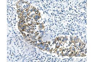 IHC analysis of Cytokeratin 18 using anti-Cytokeratin 18 antibody (ABIN7600573).
