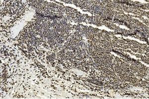 Immunohistochemistry (IHC) image for anti-Enhancer of Zeste Homolog 2 (EZH2) antibody (ABIN659002)