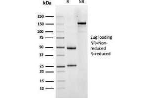 SDS-PAGE Analysis Purified LHCGR Mouse Monoclonal Antibody (LHCGR/1417). (LHCGR Antikörper  (AA 70-410))