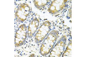 Immunohistochemistry of paraffin-embedded human colon using MyD88 Antibody (ABIN6128257, ABIN6144228, ABIN6144229 and ABIN6213986) at dilution of 1:100 (40x lens). (MYD88 Antikörper  (AA 60-309))
