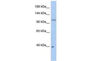 Image no. 1 for anti-E3 ubiquitin-protein ligase NEDD4-like (NEDD4L) (AA 431-480) antibody (ABIN6743164) (NEDD4-2 Antikörper  (AA 431-480))