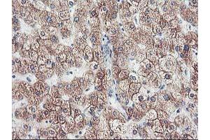 Immunohistochemical staining of paraffin-embedded Human liver tissue using anti-CYP2J2 mouse monoclonal antibody.