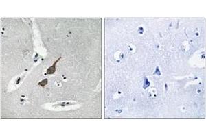 Immunohistochemistry analysis of paraffin-embedded human brain tissue, using GRID1 Antibody. (GRID1 Antikörper  (AA 831-880))