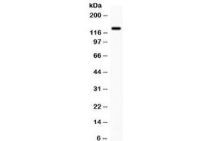 Western blot testing of human SW620 cell lysate with CDCP1 antibody. (CDCP1 Antikörper)