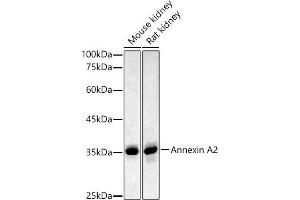 Western blot analysis of extracts of various cell lines, using Annexin  antibody  at 1:500 dilution. (Annexin A2 Antikörper)