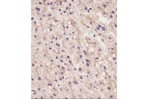 staining IL1R in human liver tissue sections by Immunohistochemistry (IHC-P - paraformaldehyde-fixed, paraffin-embedded sections).