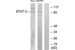 Western Blotting (WB) image for anti-Signal Transducer and Activator of Transcription 3 (Acute-Phase Response Factor) (STAT3) (AA 672-721) antibody (ABIN2889068) (STAT3 Antikörper  (AA 672-721))