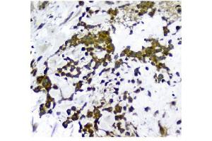 IHC analysis of NMI using anti-NMI antibody (ABIN3043451). (NMI Antikörper  (AA 2-307))