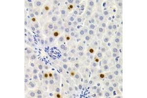 Immunohistochemistry of paraffin-embedded rat liver using GEMIN2 Antibody. (SIP1 Antikörper)