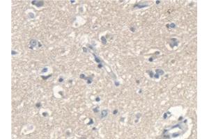 Detection of SCARA5 in Human Cerebrum Tissue using Polyclonal Antibody to Scavenger Receptor Class A Member 5 (SCARA5) (SCARA5 Antikörper  (AA 118-495))