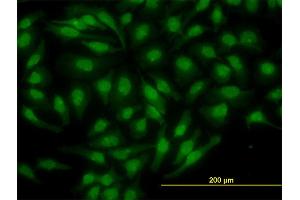 Immunofluorescence of monoclonal antibody to NR4A2 on HeLa cell. (NR4A2 Antikörper  (AA 71-170))