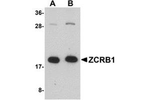 Western Blotting (WB) image for anti-Zinc Finger CCHC-Type and RNA Binding Motif 1 (ZCRB1) (C-Term) antibody (ABIN1030818) (ZCRB1 Antikörper  (C-Term))