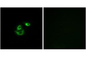 Immunofluorescence analysis of A549 cells, using CLCC1 Antibody.
