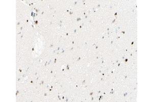 Immunohistochemistry (IHC) image for anti-Nuclear Factor of kappa Light Polypeptide Gene Enhancer in B-Cells 1 (NFKB1) (pSer893) antibody (ABIN6255551)