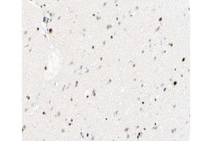 ABIN6267431 at 1/100 staining human brain tissue sections by IHC-P. (NFKB1 Antikörper  (pSer893))