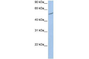 WB Suggested Anti-RIOK3 Antibody Titration:  0. (RIOK3 Antikörper  (C-Term))