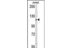 Western blot analysis of anti-USP11 Pab (ABIN388894 and ABIN2839183) in Jurkat cell line lysates (35 μg/lane). (USP11 Antikörper  (N-Term))