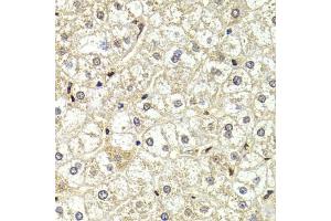 Immunohistochemistry of paraffin-embedded human liver injury using LMNB2 Antibody (ABIN5973877) at dilution of 1/200 (40x lens). (Lamin B2 Antikörper)