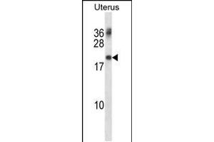 Western blot analysis in human normal Uterus tissue lysates (35ug/lane). (PMP22 Antikörper  (AA 102-130))