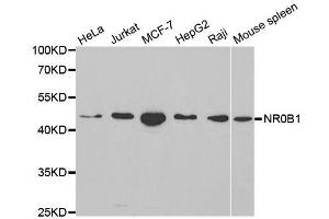 Western Blotting (WB) image for anti-Nuclear Receptor Subfamily 0, Group B, Member 1 (NR0B1) (AA 1-260) antibody (ABIN3022466)